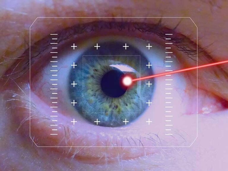 laser-femosecond-laser